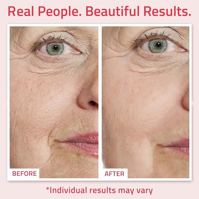 YEOUTH Retinol Serum for Face with Hyaluronic Acid & Vitamin E, Hydrating Retinol Face Serum, Skin Care Suitable for All Skin Types 1oz