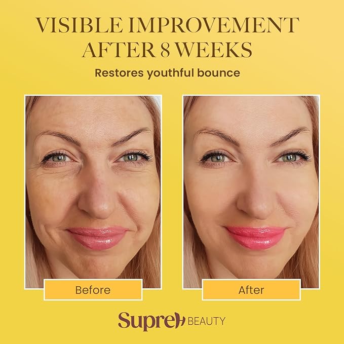 Bee Venom Wrinkle Cream: Wrinkle Cream for Women with Bee Venom Hyaluronic acid Niacinamide and Peptides - for fine lines and face firming 50ML