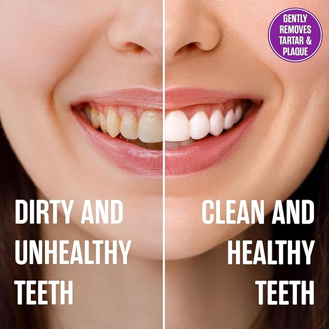 SprinJene Natural Fluoride Free Toothpaste for Sensitive Teeth & Gums – Patented Toothpaste with Black Seed Oil & Zinc – Vegan Dry Mouth Prevention for Fresh Breath – Made in The USA (1 Pack)