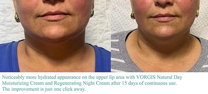 Day Moisturizing Cream with Hyaluronic Acid