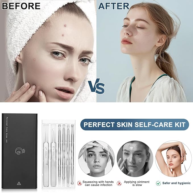 Professional Facial Blackhead Remover Tools,6-Piece Stainless Steel Acne Extractor Tools Set with Storage CaseKit for Whitehead Acne Blemishes Comedones Stainless Steel Makeup Tool