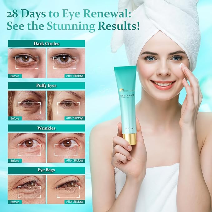 Retinol Eye Cream for Dark Circles & Puffiness - Anti-Aging Treatment with Hyaluronic Acid, Reduces Eye Bags, Wrinkles & Fine Lines | Hydrating Under Eye Care for Women & Men (1 fl oz)