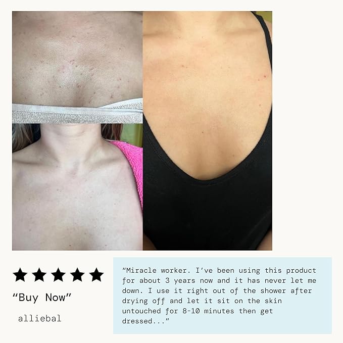 Pacifica Bacne Warrior - Bacne Salicylic Acid Spray, Back Acne Treatment Spray with 2% Salicylic Acid, Niacinamide, and Aloe, Body Acne Warrior for Body, Chest, and Back, Dermatologist Tested- 6 Fl Oz