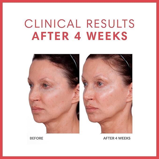 Consult Beaute Volumagen TRIO Skin Care For Plumper & Smoother Skin - Collagen, Hyaluronic Acid and Ceramides - Doctor Formulated for Face, Neck and Eyes - Boost Moisture for Glowing Complexion