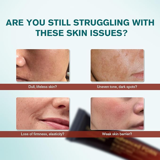 Advanced PDRN Rejuvenating Cream, 99% Pure Salmon DNA Collagen Gel Repair Cream, 0.7 oz, with Hyaluronic Acid and Niacinamide, Nighttime Skin Repair,Inspired Skincare