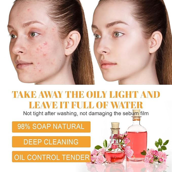 Turmeric & Kojic Acid Face Wash with Silicone Brush, Cleanser for Dark Spot Correction, with Rose Water to Soothe and Hyaluronic Acid to Hydrate, 3.38 fl oz