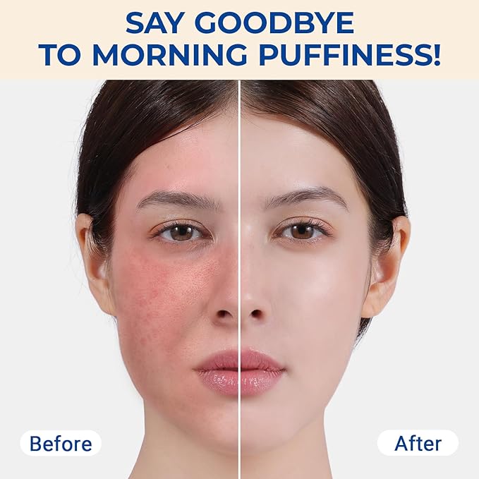 MORGLES Ice Roller for Face, Professional Face Roller Cryotherapy Tool to Reduce Puffiness, Redness & Headaches, Tighten Skin and Improve Lymphatic Drainage with Ergonomic Handle (Pink)