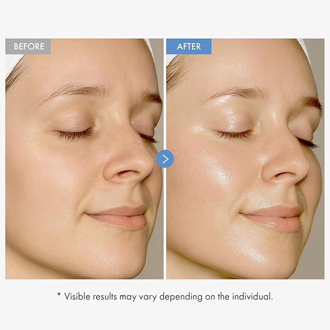 TOSOWOONG Hyaluronic Acid 9 Cream, Vitamin B5, Collagen, Niacinamide, Centella Asiatica Extract, Long-lasting Hydration, Daily Moisturizer Face Cream, Korean Skin Care, 50ml, 1.69 fl.oz.