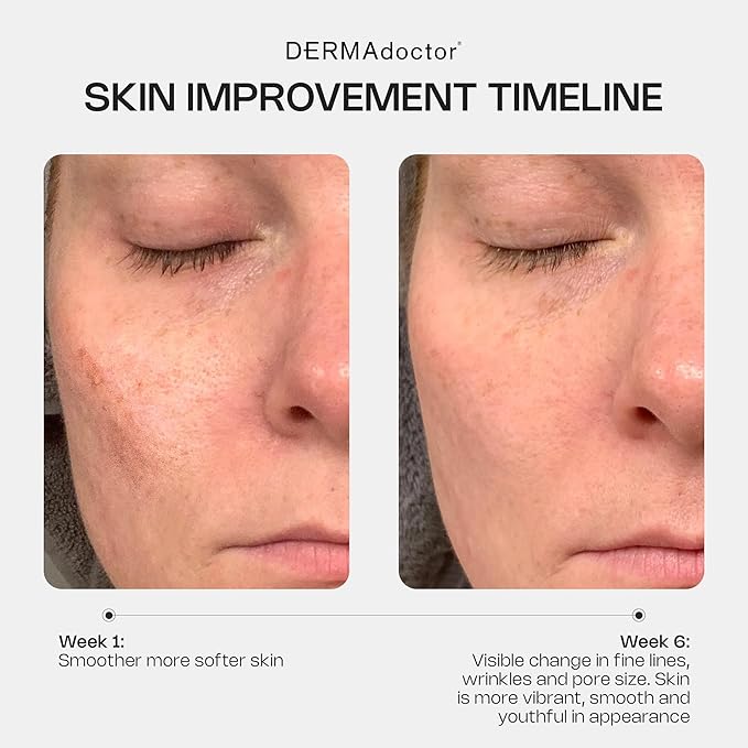 DERMAdoctor Retinol Cream for Face - Stabilized Vitamin C, Vitamin E, Ferulic Acid Anti Aging Face Cream 1% Retinol Facial Moisturizer Night-Cream for Dullness, Discoloration, Fine Lines, & Wrinkles