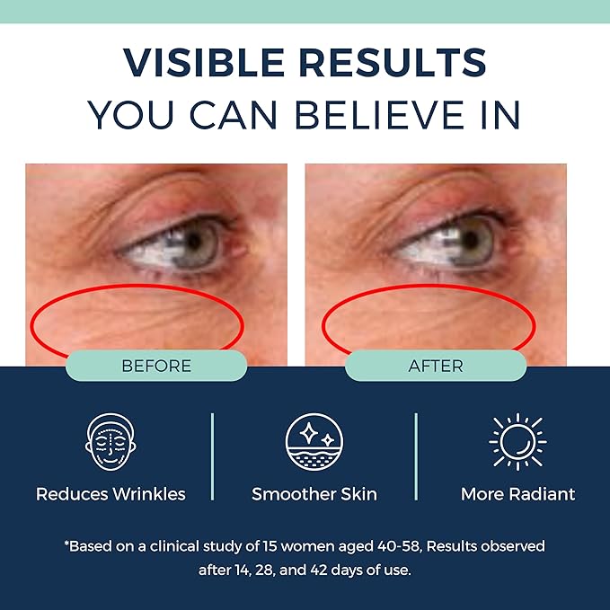 Anti-Aging Retinol Serum for Face- 1% Encapsulated Retinol, Niacinamide & Hyaluronic Acid Improves Wrinkles, Hydration, Skin Texture & Tone. Gentle for Sensitive Skin-Fragrance Free-1 FL OZ