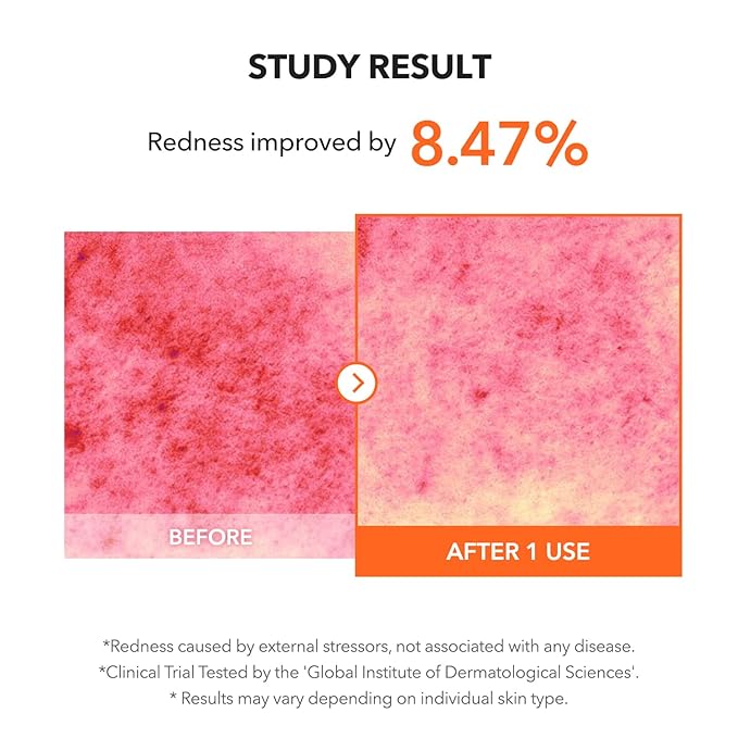 APRILSKIN Carrotene IPMP™ Clearing Solution || Quickly soothes troubled areas and helps clear blemishes | Formulated with BHA, AHA, Niacinamide & Zinc Oxide | Vegan, Cruelty-Free (0.67fl.oz.)