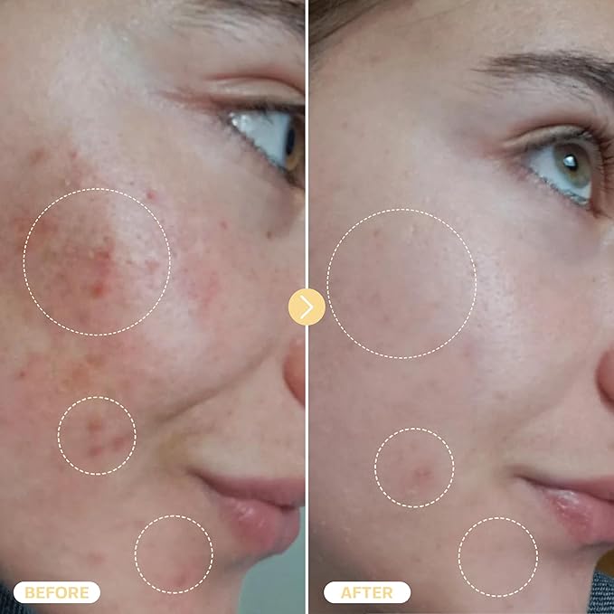 BASE LABORATORIES Hypochlorous Acid Spray for Face & Skin - Travel Size - Facial Toner Spray & Cleaner - Skin Repair Solution helps reduce redness, Irritations, acne - HOCL Molecule Spray 2oz