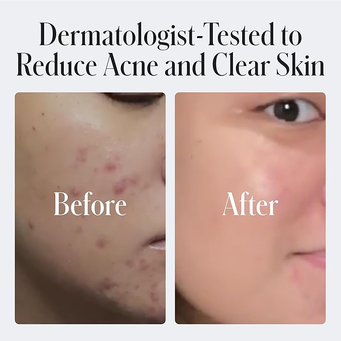 Geologie 2% Salicylic Acid Unscented Face Wash | Fragrance-Free Facial Cleanser for Men & Women | Acne & Oil Control | Non-irritating, Deep Cleansing & BHA Exfoliating Face Wash | 2-Pack