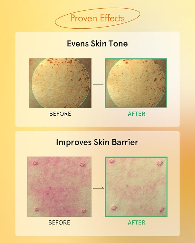 ATHE Toning Vita EGF Serum - Korean Skin Repairing Serum with Vitamin C - Hydrating & Soothing Hypoallergenic Ampoule for Day & Night Use, 1.01 fl.oz.