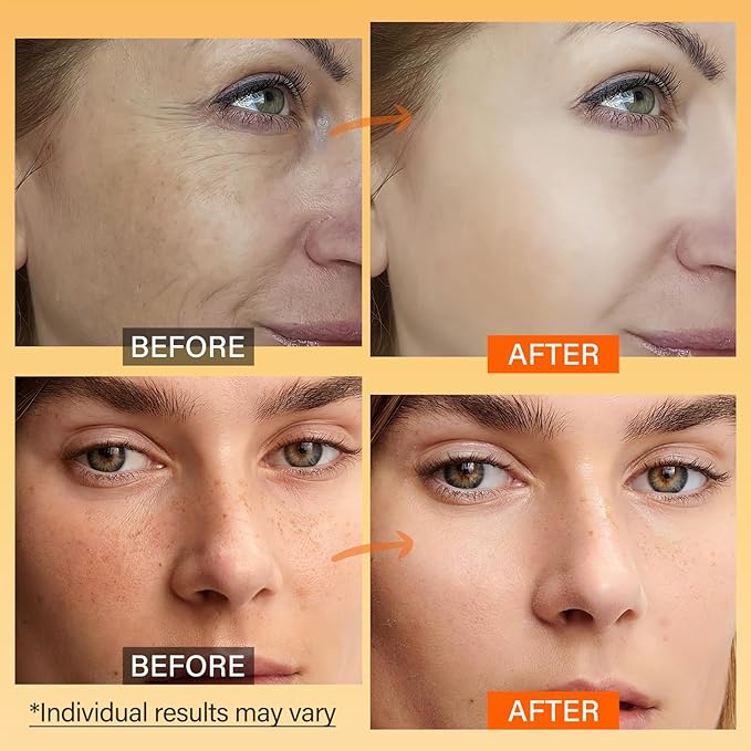 Vitamin C Face Moisturizer, Brightening & Anti-aging Face Cream with Turmeric for Dark Spots, Wrinkles & Uneven Tone, Glowing Skin Care Hydrating with Niacinamide & Squalane for All Skin Types, 2.3 Oz