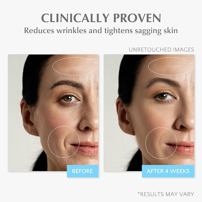 Retinol Anti Aging Face Moisturizer: Wrinkle Cream for Women, Collagen Day Night Repair Cream - Firming, Tightening & Lifting Neck Sagging Skin, 7% Hyaluronic Acid for Max Hydration, 1.7 Oz