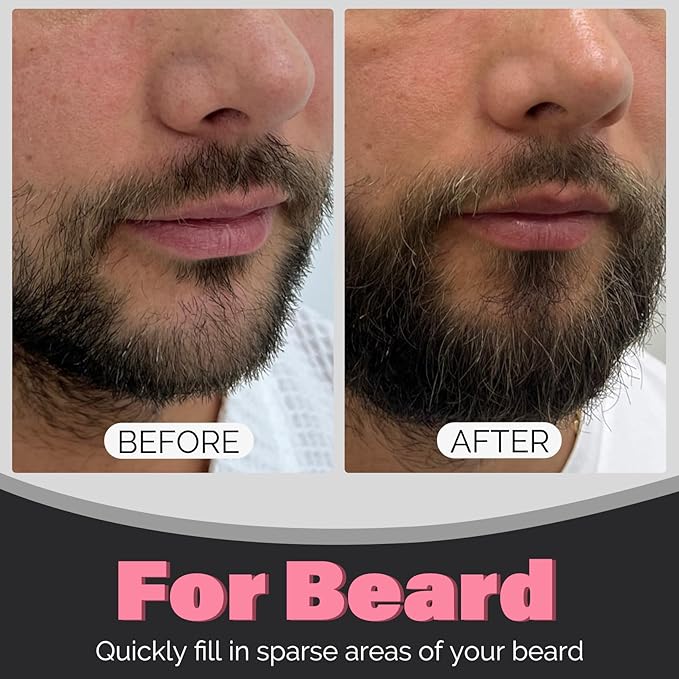 VOLLUCK Dual-Ended Hairline Powder Brush, 2-in-1 Travel Makeup Brush Set with Sponge & Root Angled Concealer/Contour Tip for Seamless Blending Root Touch Up, Soft, Easy to Color