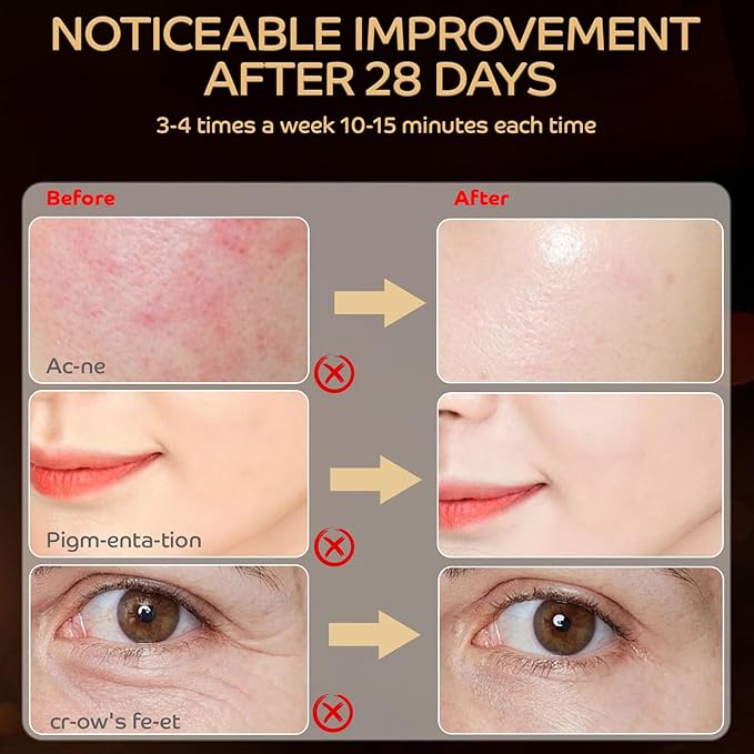 Red Light Therapy for Face, LED Red Light Therapy Mask 660nm & 850nm Wavelength for Home Use