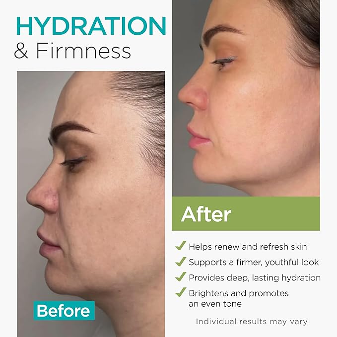 Collagen NAD+ Cream for Face Retinol Hyaluronic Acid Niacinamide for All Skin Types - Anti-Aging Face Moisturizer with Airless Pump - Day & Night Cream for Wrinkles - Made in USA 1.7 Oz