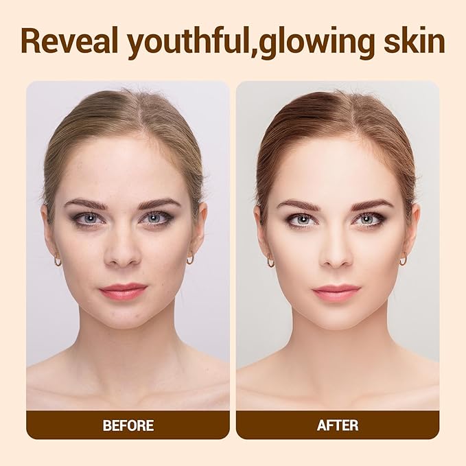 Snail Mucin Cream 99.3% Moisturizer Face Cream 4.23 Fl Oz Daily Face Moisturizer for Dry Skin Sensitive Skin Acne-prone Face Lotion