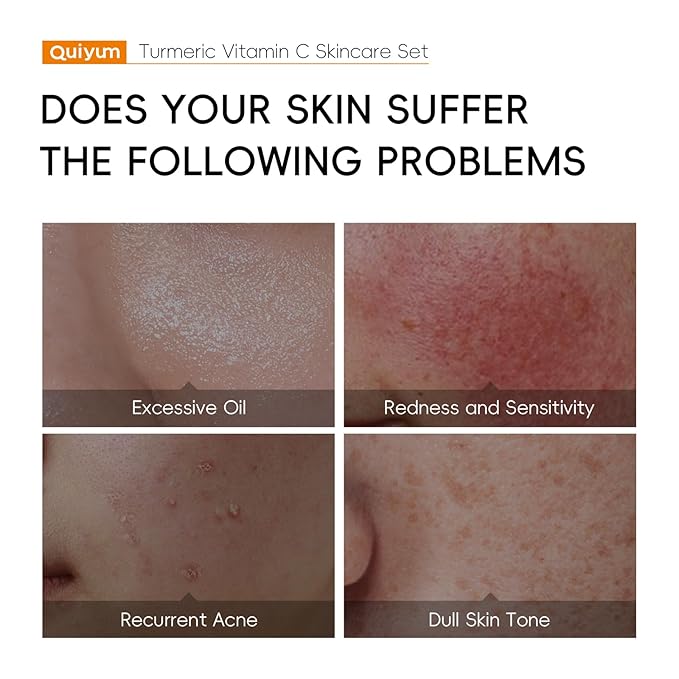 Skin Care Set, Turmeric Vitamin C Beauty Gift Sets, Skincare Kit with Serum, Eye Cream, Cream, 2 Type Mud Mask, Soap, Facial Oil Travel Kit for Women, Improve Dark Spot, Reduce Acne