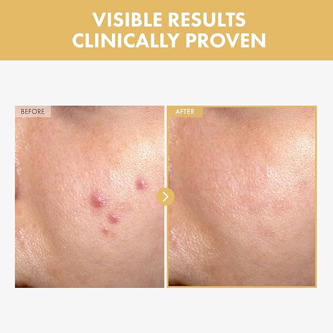 TOSOWOONG Black Snail Ginseng Serum, Ginseng 640,430ppm, Snail Mucin, Hydrating Facial Moisturizer, Acne Scar Remover, Self Care, Glow Skin Under Makeup, Korean Skin Care, 30ml, 1.01 fl. oz.