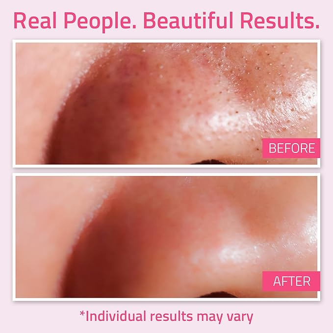 YEOUTH Dead Sea Mud Mask for Face with Hyaluronic Acid and Avocado Oil, Revitalizing Face Masks for Smoother Looking Skin 8oz