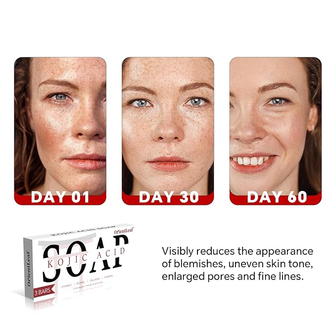 Kojic Acid Soap, Turmeric Soap Bar for Dark Spots, Fresh Citurs Scent, Gentle for Face and Body Wash with Vitamin C, Shea Butter, Retinol, Olive Oil, Collagen (3 PACK)