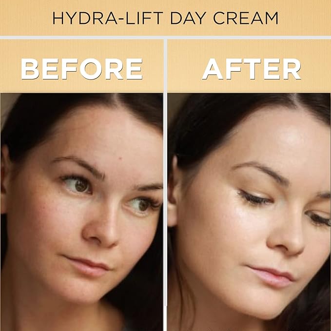 Boto-Derm Rx Day Cream, 1.35 fl oz, Anti-Aging and Anti-Wrinkle Cream for Women, Skin Tightening Cream, Anti-Aging Skin Care and Wrinkle Treatment