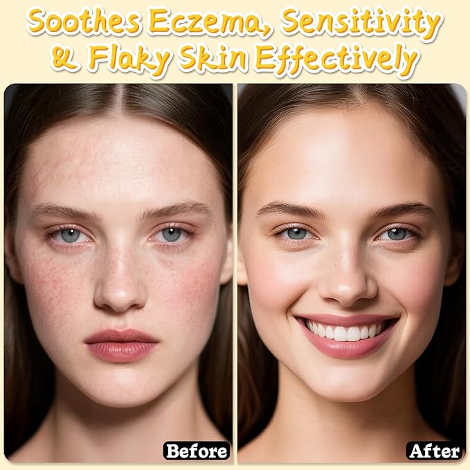 Beef Tallow for Skin, Tallow and Honey Balm for Face, Skin Care Cream Body Butter, Natural Formula, Nourish and Soothe Dry Skin, 120g/4.2oz