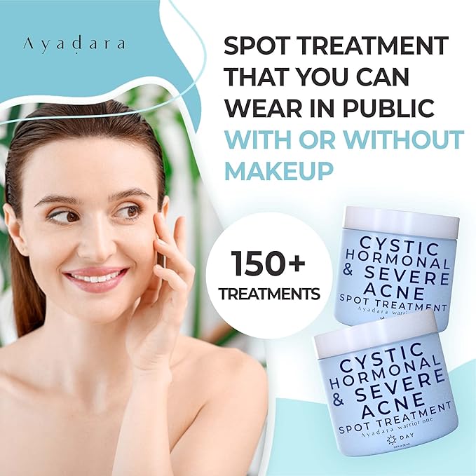 Warrior One (0.5oz) Acne Spot Treatment with 2% Salicylic Acid, Cystic and Hormonal Acne Cream, Acido Salicilico Acne Spot Treatment for Face, acne Cream for Adults and Teens, 150+ Uses