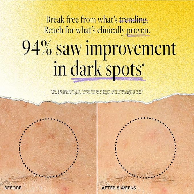 DERMA E Vitamin C Concentrated Serum with Hyaluronic Acid, Vitamin E & Aloe, All Natural, Antioxidant-Rich Concentrated Facial Serum – Firming and Brightening Vitamin C Face Serum, 2oz