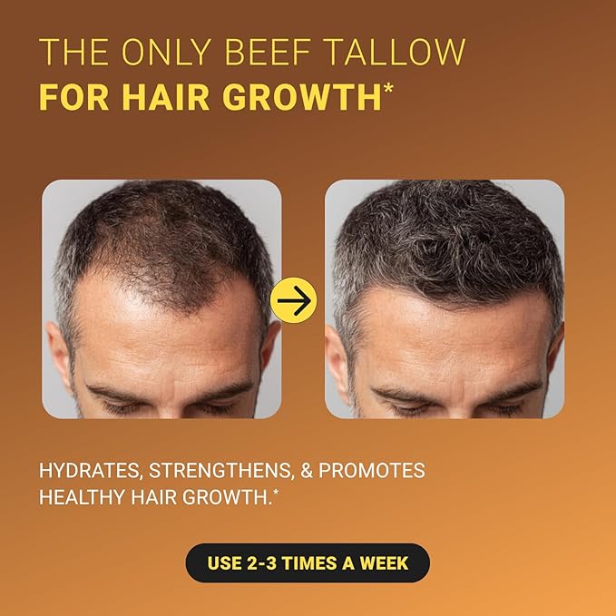 Non-Greasy Beef Tallow for Skin 5OZ Shea Butter, Vitamin E, Whipped Grass Fed Beef Tallow for Face Moisturizer Cream, Body, Hair, Lotion for Women & Men, Anti-Aging Face Moisturizer