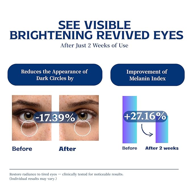 Re.SPN Peptide Firming Roller Eye Serum – For Puffy Eyes, Wrinkles & Dark Circles, Cooling Gua Sha Metal Applicator with Niacinamide, Vegan K-Beauty (0.67 fl oz)