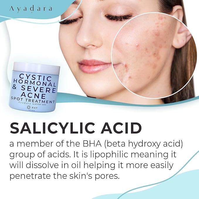 Warrior One (0.5oz) Acne Spot Treatment with 2% Salicylic Acid, Cystic and Hormonal Acne Cream, Acido Salicilico Acne Spot Treatment for Face, acne Cream for Adults and Teens, 150+ Uses