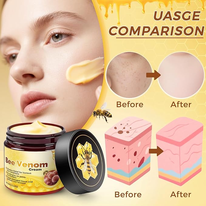 Bee Venom Skin Treatment Cream, Upgrade restoration Cream For All Skin Type (2 PCS)
