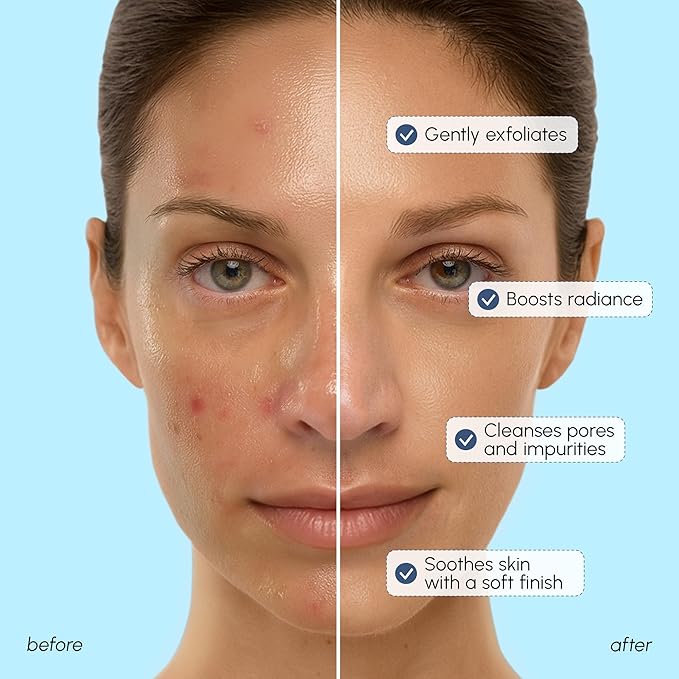 MAREE Face Exfoliator — Microdermabrasion Facial Scrub & Exfoliating Face Wash for Women — Collagen & Glycolic Acid — Gentle Scrub and Exfoliant — Men Exfoliating Scrubber — Exfoliante Facial Cleanser