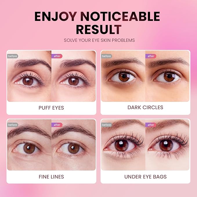 Under Eye Patches (24 Pairs) - New Tri-color Glitter Eye Gel Pads for Dark Circles Puffy Eyes,Under eye Bags,Wrinkles|Natural Collagen Under Eye Mask Patches, Gel Under Eye Patches