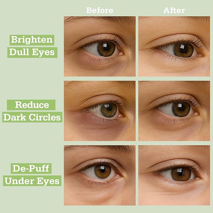 SoMatcha Calm Repair 5′ Hydrogel Under-Eye Patches, 28 Pairs — 5-Minute Soothing, Antioxidant Support & Deep Hydration — Ophthalmologist Tested