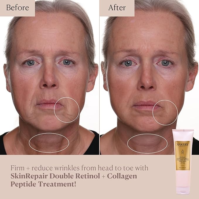 Nakery Beauty Retinol Cream with Collagen and Hyaluronic Acid, Anti Aging Moisturizer for Wrinkles, Face Treatment for All Skin Types, Day and Night Formula for Women