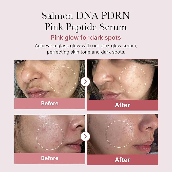 medicube Pink Glass Glow Skin Trio: Salmon DNA PDRN pink collagen jelly gel mask (4ea) and PDRN Pink Peptide Serum, glow serum and Collagen Jelly Cream 50ml
