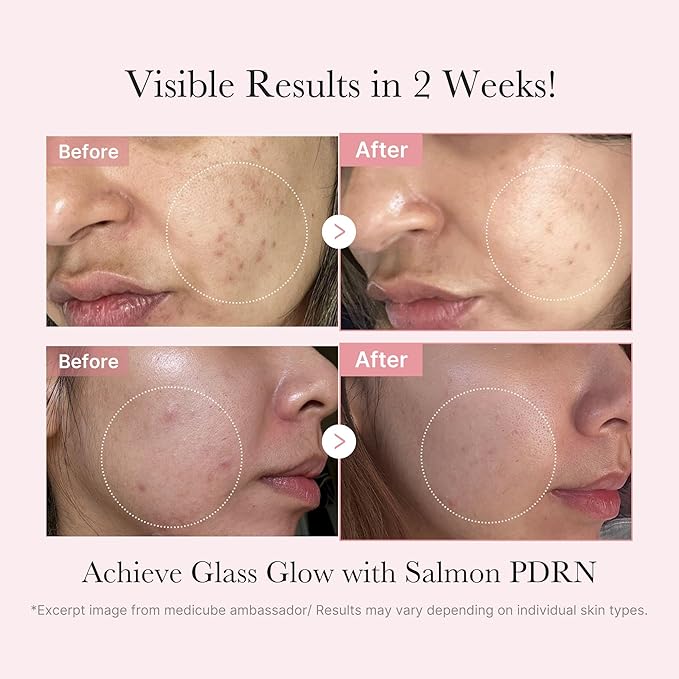 medicube Salmon DNA PDRN Trial Kit | Glass Glow Mini Skincare Set with Toner, Serum & Sheet Mask for Hydrating, Firming, Moisturizing |Gift & Travel Essentials for Women & Girls | Korean Skincare