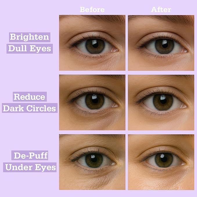 Lavender Pop Calm Repair 5′ Hydrogel Under-Eye Patches, 28 Pairs — 5-Minute Soothing & Calming, Brighter-Looking Under-Eyes — Natural Lavender Note · Ophthalmologist Tested