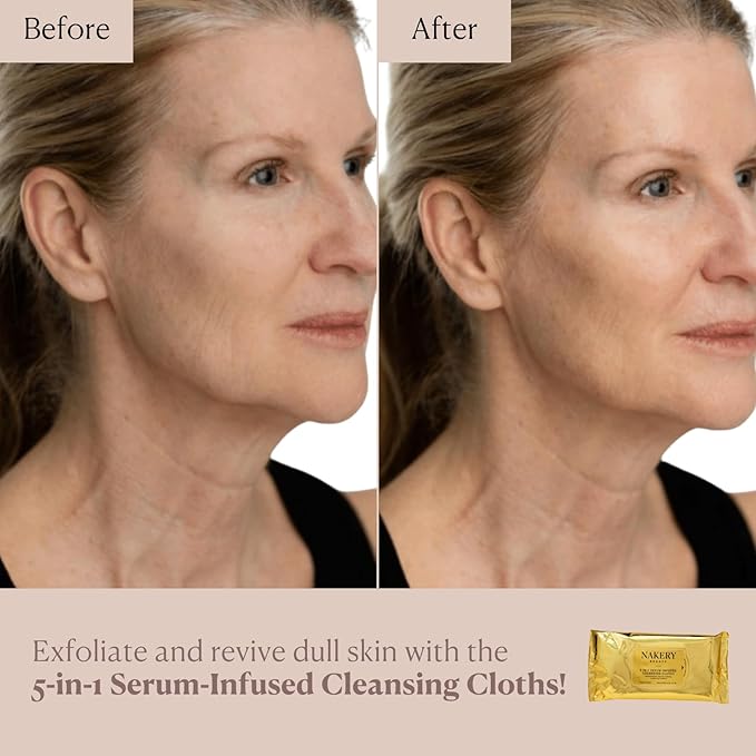 Nakery Makeup Remover Wipes for Face, 5-in-1 Infused Cleansing Towelettes, Gentle Exfoliating Wipe for Women, Eye Makeup Eraser for Sensitive Skin, Anti Aging Skincare, Hydrating Formula