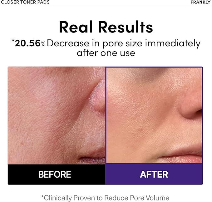 FRANKLY Pore Closer Toner Pads l Rice Jelly Pads with 9 Peptides, Vegan Collagen, Rice Extract l Pore Minimizer l Hydrating for All Skin Types l Korean Skin Care