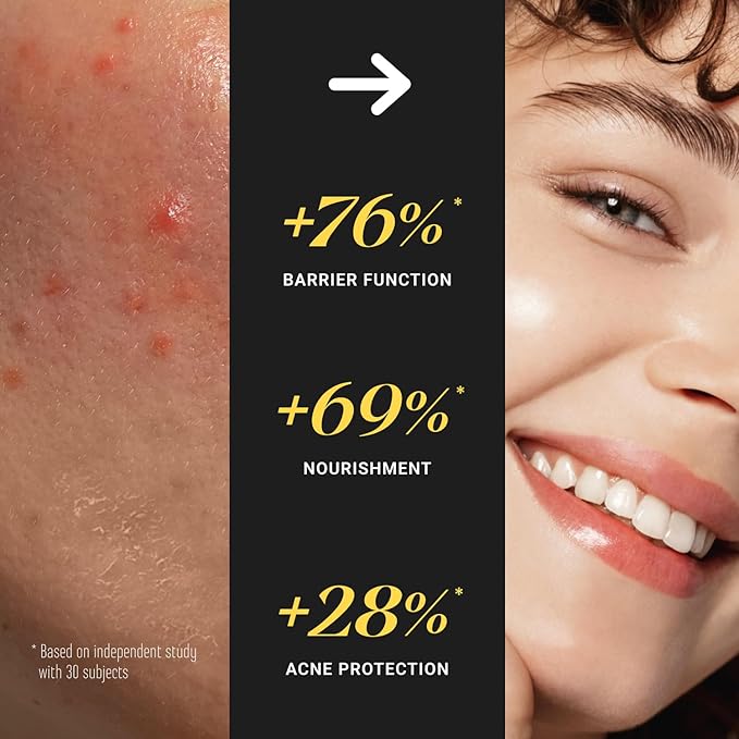 Non-Greasy Beef Tallow for Skin 5OZ Shea Butter, Vitamin E, Whipped Grass Fed Beef Tallow for Face Moisturizer Cream, Body, Hair, Lotion for Women & Men, Anti-Aging Face Moisturizer