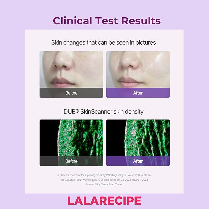 Bakuchiol First Essence – Hydrating Milky Korean Toner with Retinol Liposome, Shea Butter & Peptides – Vegan Skincare for Wrinkle Care & Elasticity (5.24 fl oz)