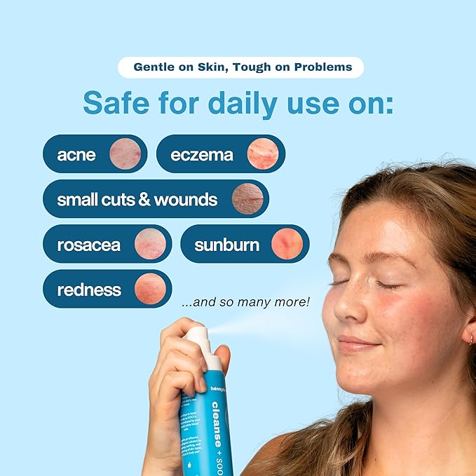 Honeydew Labs Hypochlorous Acid Spray – HOCl Face & Skin Mist for Acne, Eczema & Irritation – Multi-Purpose Skin Repair – Eyelid Cleanser, Post-Workout, Post-Procedure, Scalp, Sensitive Skin TSA 2 oz