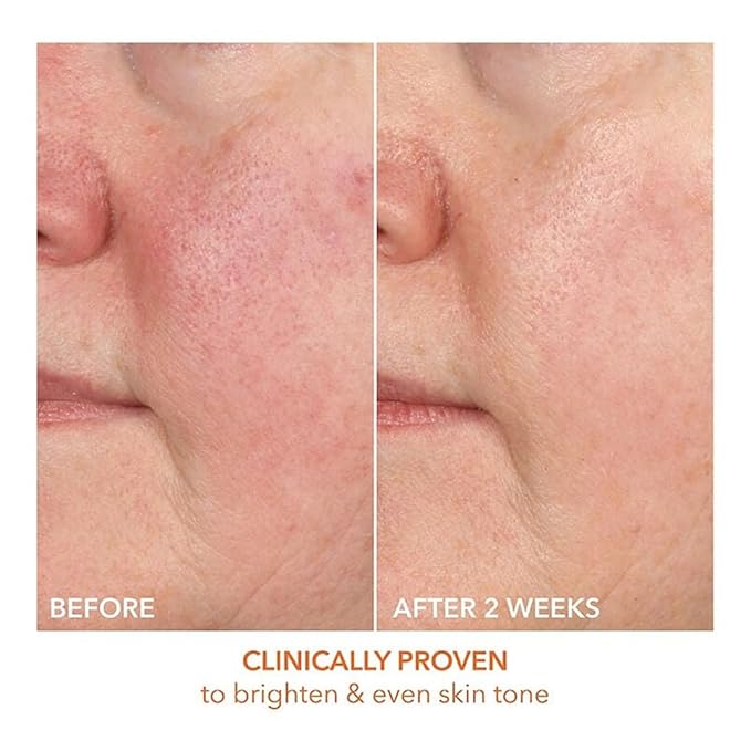 Dr Dennis Gross Vitamin C Lactic 15% Firm & Brighten Serum: Visibly Improve Signs of Aging, 1 oz