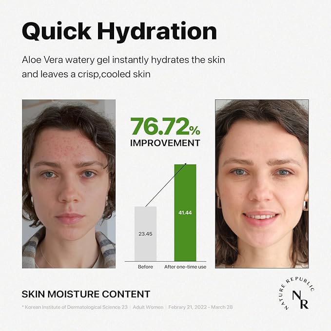 Nature Republic MILD & MOISTURE ALOE VERA WATERY GEL (3 PCS) Quick Hydration & Moisturizing,fast absorbing non-sticky texture,korean skin care for Face,Hair,Sunburn relief, aftershave, all Skin Types